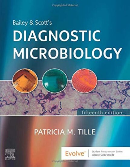 Bailey & Scott's Diagnostic Microbiology, 15th Edition by Patricia Tille 2021 Test Bank